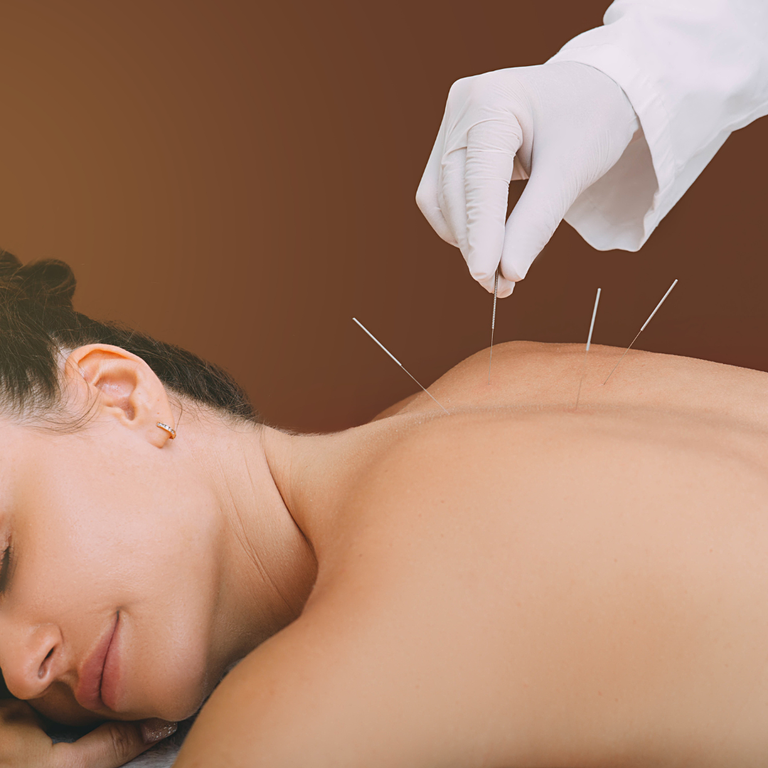 Acupuncture Or Cognitive Behavioral Treatment Are Two Options