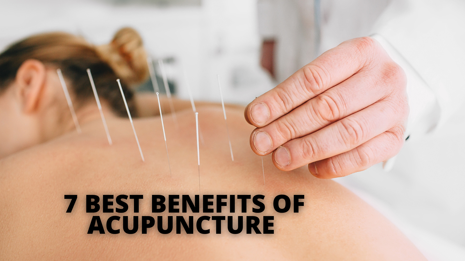 7 Best Benefits Of Acupuncture